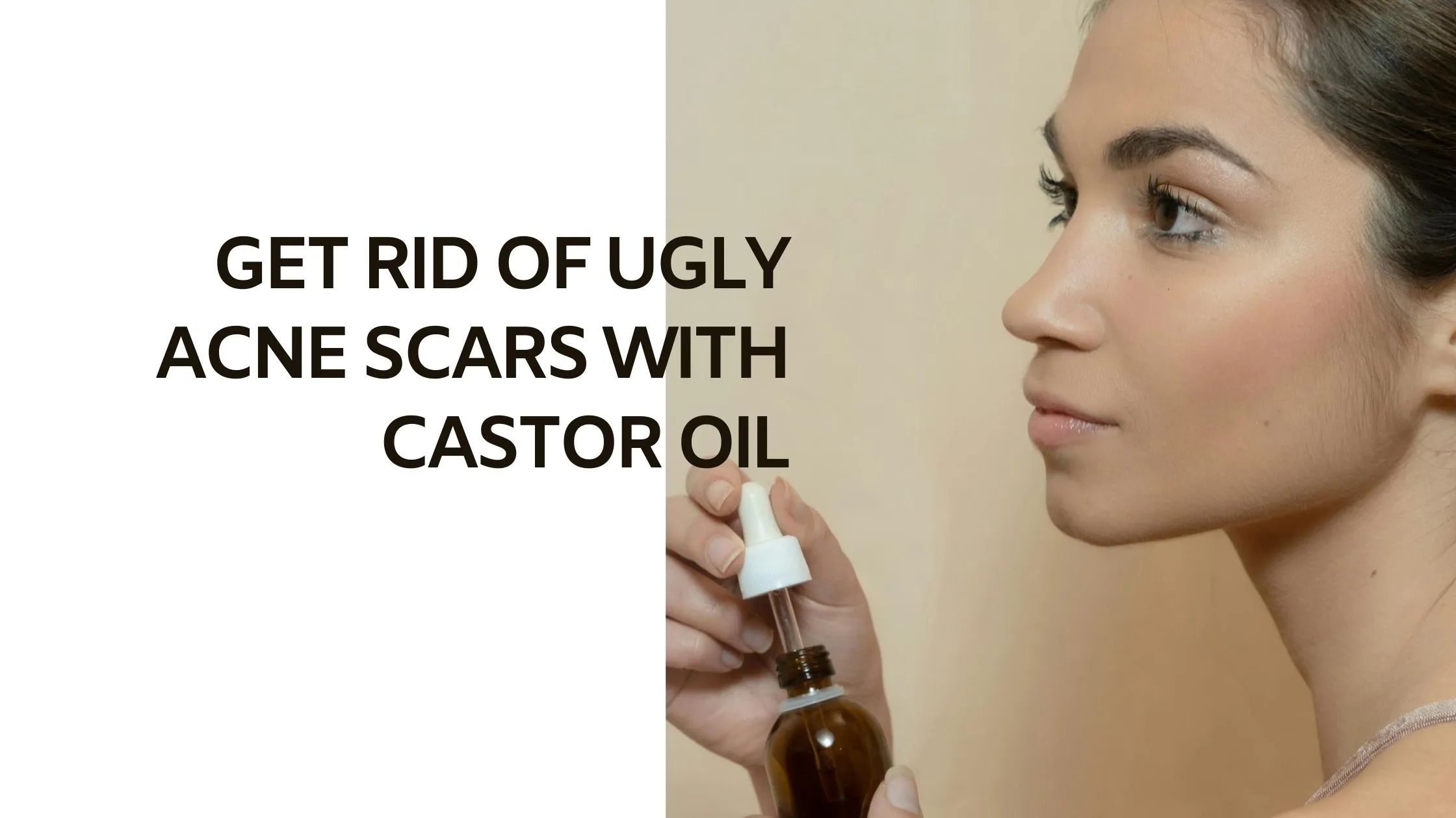 Castor Oil For Your Acne, Pimples & Their Scars.